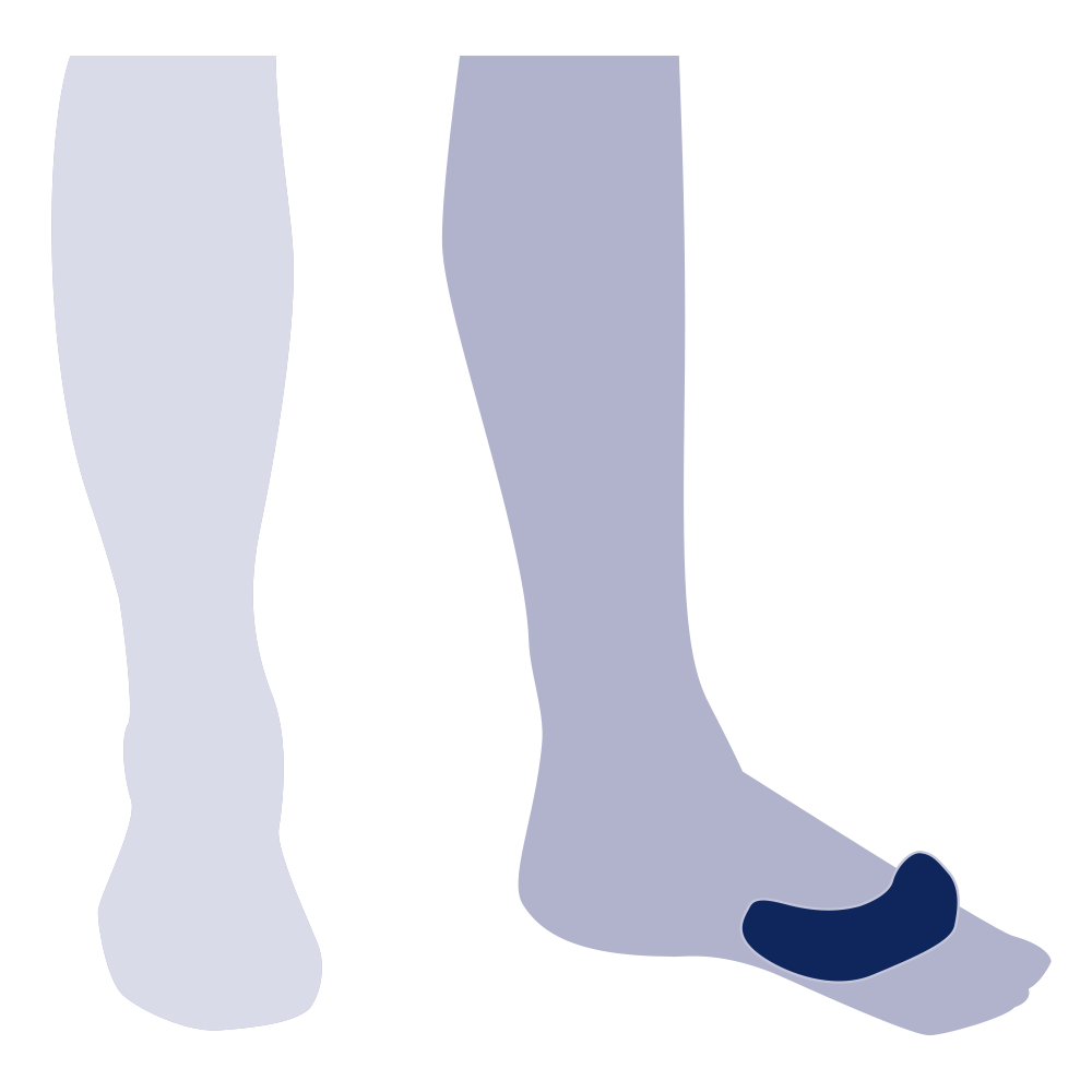 Crescent
